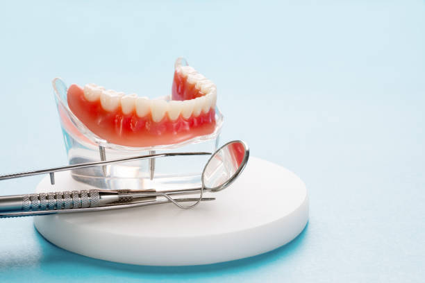 Dental Inlays and Onlays in Varnell, GA