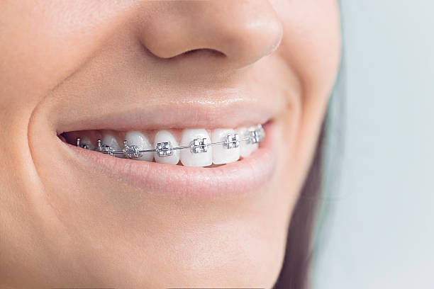 Best Teeth Whitening  in Varnell, GA